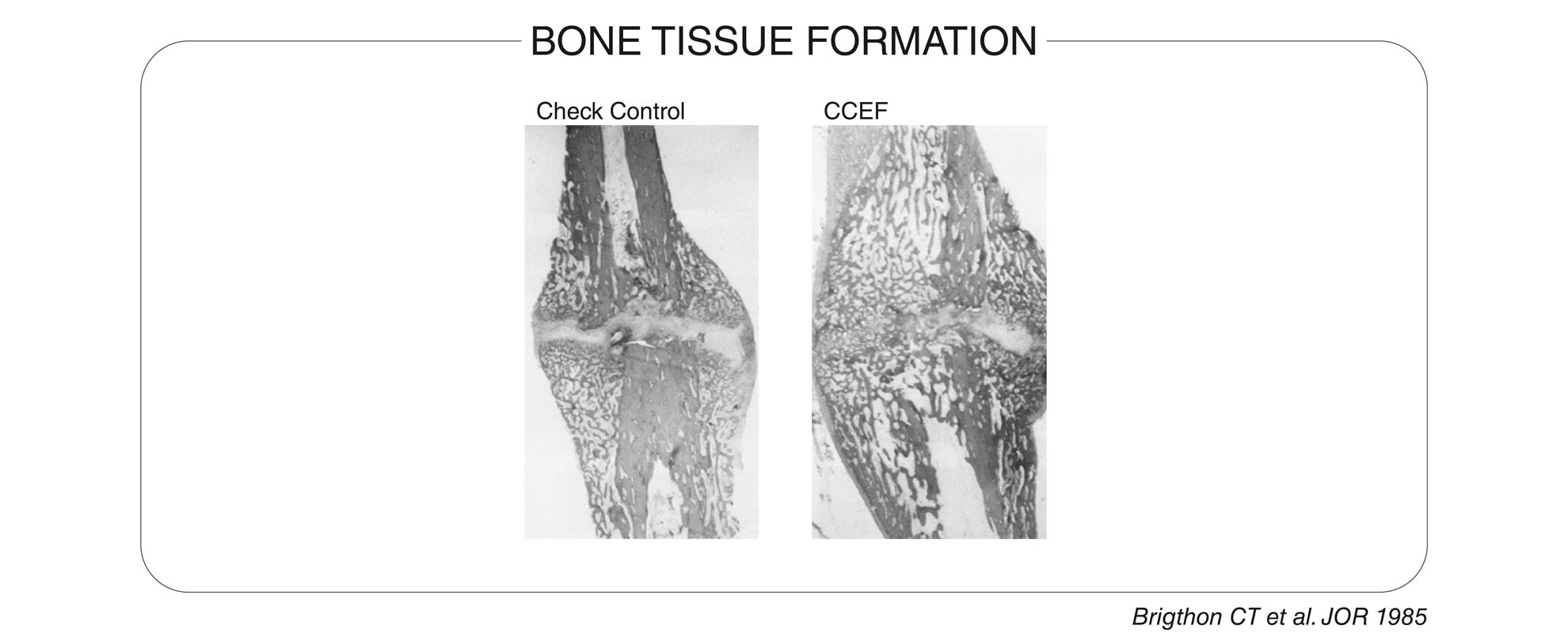 Bone tissue formation-2